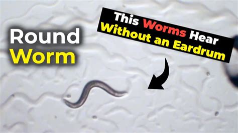 Can worms hear things?